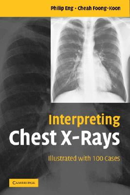 Interpreting Chest X-Rays Illustrated with 100 Cases